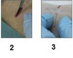 ترمیم زخم‌ها در مدت چند ثانیه با نانوچسب ژله‌ای + عکس