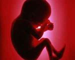 پارازیت ها سقط جنین و بارداری خارج از رحم را افزایش داده است