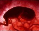تاثیر چاقی و دیابت مادر بر رشد بسیار سریع جنین