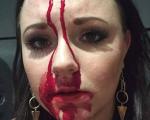 حمله خونین دختر جوان به سرآشپز بخاطر غذای گران + تصویر