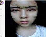 دختر 15 ساله جراحی زیبایی کرد تا شبیه عروسک شود! +تصاویر