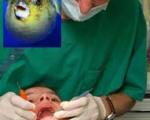 خبری بد برای آنها که از دندانپزشکی می‌ترسند:انسان آینده منقاردار می‌شود!