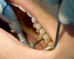 دلیل درد فردای دندانپزشکی چیست؟