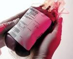 عوارض حاد مرتبط با تزریق خون (2)