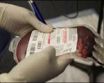 تزریق نخستین خون مصنوعی به انسان/ پایان عصر اهدای خون (+تصاویر)