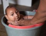 خبر خوب برای دنیا؛ زنی مبتلا به ویروس زیکا کودکی سالم به دنیا آورد