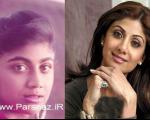 تصاویری از زنان بازیگر معروف بالیوود قبل و بعد از جراحی زیبایی