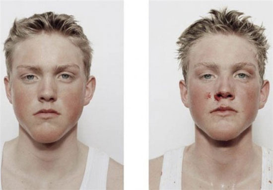 بوکسورهای جوان قبل و بعد از مبارزه +عکس