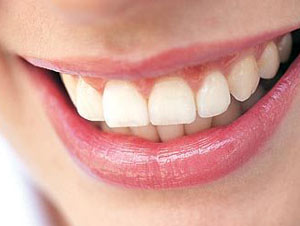 دندان,پیشگیری از پوسیدگی دندان,علل پوسیدگی دندان