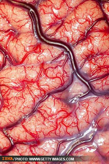 تصاویر زیبای پزشکی , تصویر جراحی مغز