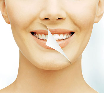 بلیچینگ، کامپوزیت یا لامینیت؛ بهترین روش برای سفید کردن دندان کدام است؟!