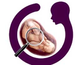 تشخیص بیماری‌ها قبل از تولد,بیماری‌ها قبل از تولد