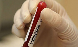 آزمایش خون,سنجش میزان عمر باآزمایش خون