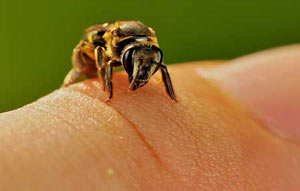 زنبور عسل, آلرژی به نیش زنبورها