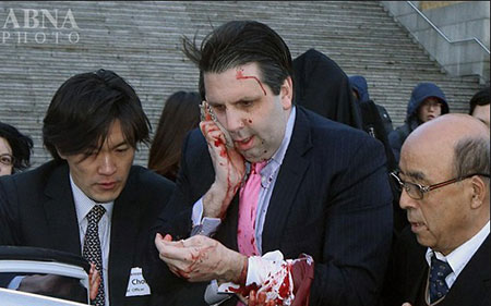 اخبار,اخبار بین الملل, حمله با  به سفیر آمریکا در کره جنوبی