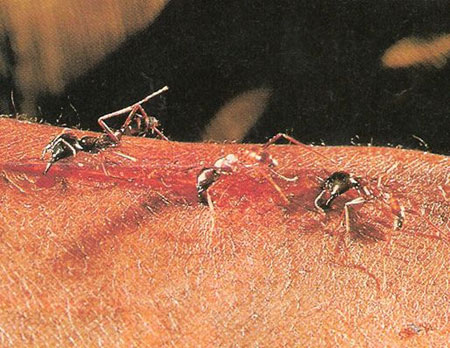 مورچه‎های حیرت انگیز که جراحی می‎کنند+عکس