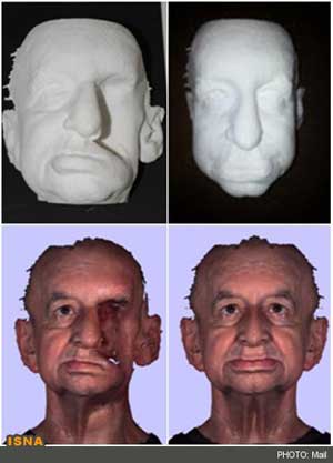 تولید اجزای چهره بیمار سرطانی با پرینت سه بعدی