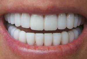 حساسیت دندان, درمان حساسیت دندانی