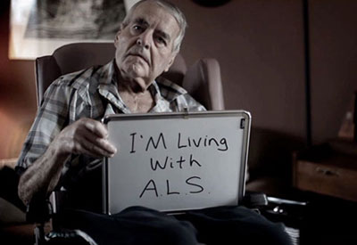 درمان بیماری ALS, تشخیص بیماری ALS