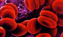 چگونه بفهمیم کم خونی داریم؟