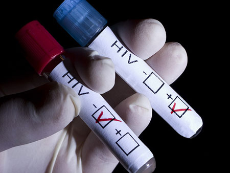 این آزمایش ها تکلیف ایدز را روشن می کنند
