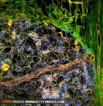 تصاویر زیبای پزشکی , تصویر جراحی مغز