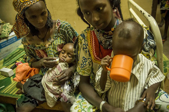 بحران سوء‌تغذیه کودکان افریقای‌مرکزی