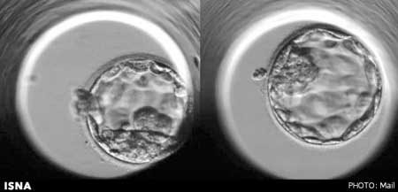 اخبار , اخبار علمی,تصاویر لقاح جنین های دوقلو,مراحل لقاح جنین
