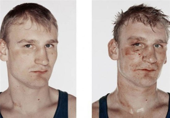 بوکسورهای جوان قبل و بعد از مبارزه +عکس