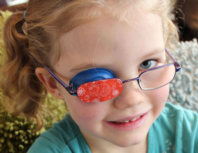 علل انحراف چشم,درمان انحراف چشم در کودکان