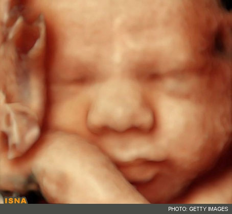 نمایش لبخند جنین در رحم با فناوری جدید
