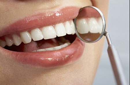کشیدن دندان ها,درمان ارتودنسی,درمان لامینیت