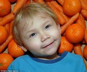 این پسر با خوردن هویج پوست بدنش نارنجی میشود +عکس