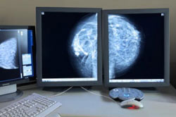 ماموگرافی,ماموگرافی چیست,آزمایش ماموگرافی