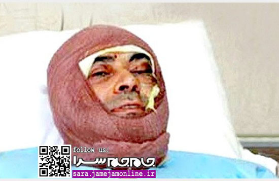 رئیس بیمارستان ضیاییان بعد از اسید پاشی +عکس