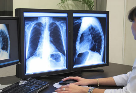 رادیولوژی,تاریخچه کشف پرتو ایکس,17 آبان روز جهانی پرتونگاری