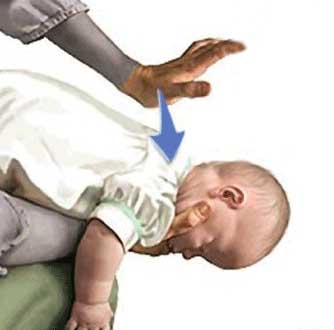 گیرکردن اجسام در گلوی بچه