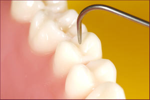 ورود فناوری جدید به عرصه دندانپزشكی