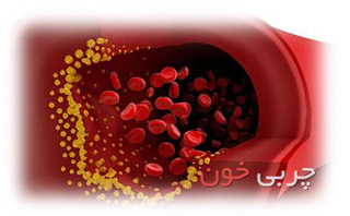 چربی خون, پیشگیری از چربی خون, کنترل چربی خون