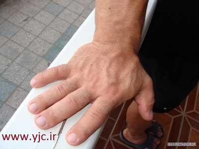 بزرگترین دست های دنیا,اندازه دست یک فرد سالم و بالغ, دنیس سایپلنکوو