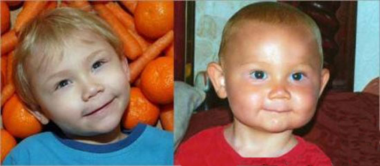 این پسر هویج بخورد، نارنجی میشود! +عکس