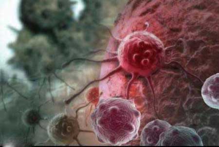 تشخیص زودهنگام سلول های سرطانی با ایمپلنت اسفنجی