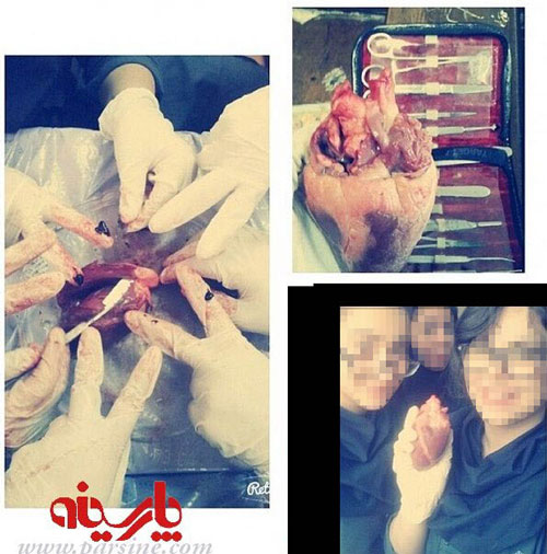 سلفی دانشجویان پزشکی با اجساد! (18+)