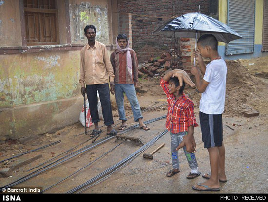 پسربچه‌ هندی با دست‌های غول‌آسا +عکس