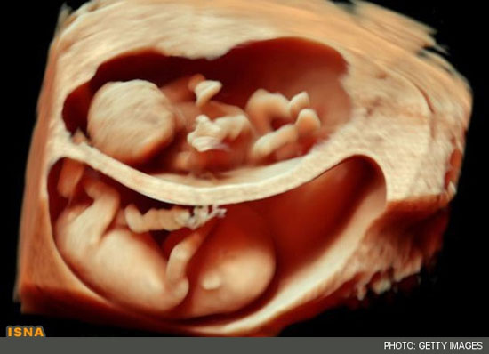 نمایش لبخند جنین در رحم با فناوری جدید