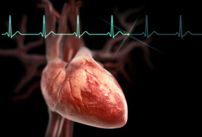 علل کاهش ضربان قلب, سنکوپ کردن