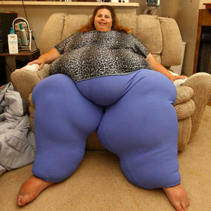 چاق ترین زن جهان رژیم می گیرد