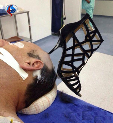 پاشنه کفش زن در سر شوهر جا ماند! +عکس