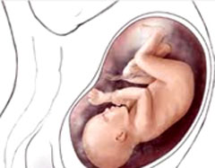 بارداری,سقط جنین,بارداری پس از سقط