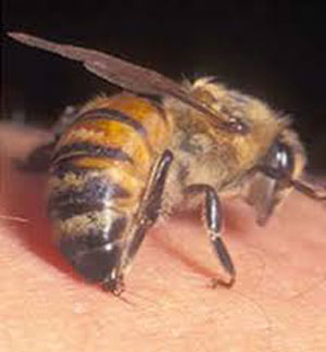 زنبورردگی,زنبورگزیدگی